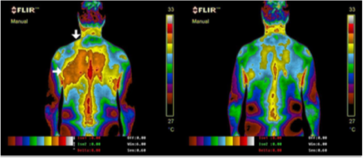 case study with 54 year old man with neck and back pain