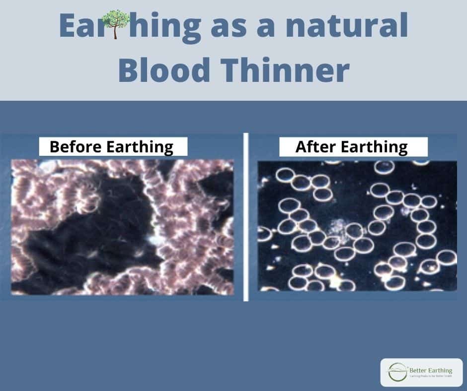 Earthing before and after